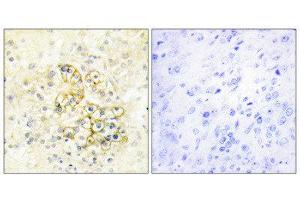 Immunohistochemistry (IHC) image for anti-Prostate Transmembrane Protein, Androgen Induced 1 (PMEPA1) (Internal Region) antibody (ABIN1849883) (PMEPA1 Antikörper  (Internal Region))
