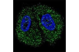 Fluorescent confocal image of MCF7 cells stained with PKM2 antibody. (PKM2 Antikörper  (AA 476-505))