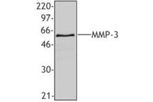 Image no. 1 for anti-Matrix Metallopeptidase 3 (Stromelysin 1, Progelatinase) (MMP3) antibody (ABIN205498) (MMP3 Antikörper)