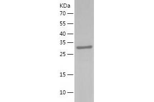 Western Blotting (WB) image for Sulfotransferase Family, Cytosolic, 1C, Member 2 (SULT1C2) (AA 1-296) protein (His tag) (ABIN7125236)