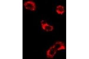 Immunofluorescent analysis of EEF1D staining in U2OS cells. (EEF1D Antikörper)