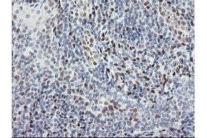 Image no. 6 for anti-Transducin-Like Enhancer of Split 1 (E(sp1) Homolog, Drosophila) (TLE1) (AA 180-460) antibody (ABIN1491050)