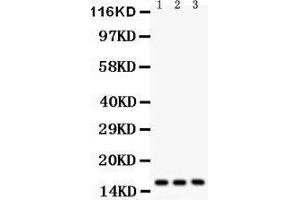 Anti-Survivin antibody, Western blotting All lanes: Anti Survivin  at 0. (Survivin Antikörper  (AA 1-140))