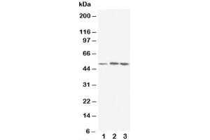 Western blot testing of NR1H3 antibody and Lane 1:  rat liver (NR1H3 Antikörper  (AA 375-398))