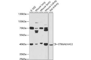 Western blot analysis of extracts of various cell lines, using ST6G antibody (ABIN7270579) at 1:1000 dilution. (ST6GALNAC2 Antikörper  (AA 30-200))