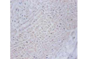 Immunohistochemistry of paraffin-embedded human umbilical cord tissue using ABIN7149009 at dilution of 1:100 (CSRP2 Antikörper  (AA 2-193))