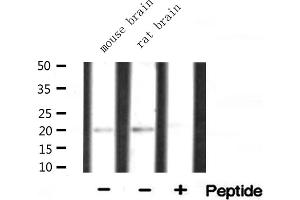 Western blot analysis of extracts of various tissue ,using RPL15 antibody (RPL15 Antikörper  (C-Term))