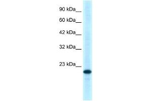 WB Suggested Anti-TNFRSF18 Antibody Titration:  0. (TNFRSF18 Antikörper  (C-Term))