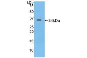 Western blot analysis of recombinant Human DMD. (Dystrophin Antikörper  (AA 3048-3328))