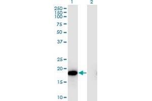 Western Blot analysis of HSPB6 expression in transfected 293T cell line by HSPB6 monoclonal antibody (M03), clone 6A4.