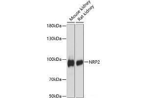 Western blot analysis of extracts of various cell lines using NRP2 Polyclonal Antibody at dilution of 1:3000. (NRP2 Antikörper)