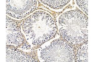 ABIN7096183 and ABIN7100245 at 1/100 staining rat testis tissue by IHC-P. (FAM181A Antikörper)