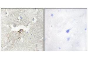 Immunohistochemistry (IHC) image for anti-Lemur tyrosine Kinase 2 (LMTK2) (Internal Region) antibody (ABIN1849762) (LMTK2 Antikörper  (Internal Region))