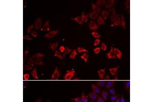 Immunofluorescence analysis of A549 cells using LIMS1 Polyclonal Antibody (LIMS1 Antikörper)