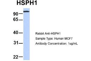 Host: Rabbit  Target Name: HSPH1  Sample Tissue: Human MCF7  Antibody Dilution: 1.