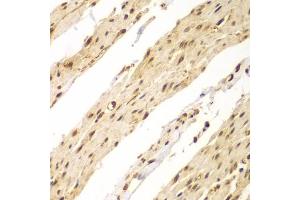 Immunohistochemistry of paraffin-embedded human colon using CDX1 antibody (ABIN2561793) at dilution of 1:100 (40x lens).