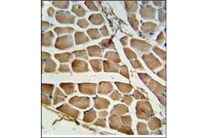 AP17920PU-N CARD4 antibody staining of Formalin-Fixed, Paraffin-Embedded Human skeletal muscle tissue. (NOD1 Antikörper  (C-Term))