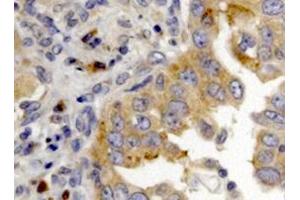 Image no. 1 for anti-Dicer 1, Ribonuclease Type III (DICER1) antibody (ABIN577054)
