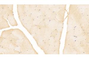 Immunohistochemistry (IHC) image for anti-Mesothelin (MSLN) (AA 296-606) antibody (ABIN7427201)