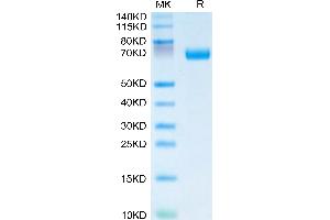 IL20RA Protein (AA 30-250) (Fc Tag)