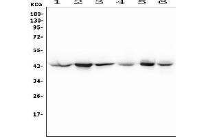 Western blot analysis of MAP2K4 using anti-MAP2K4 antibody (ABIN6719495).