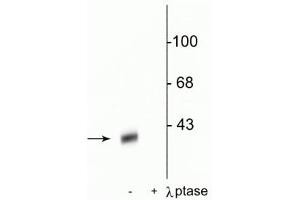 Western blot of rat striatal lysate showing specific immunolabeling of the ~32 kDa DARPP-32 phosphorylated at Thr34 in the first lane (-). (DARPP32 Antikörper  (pThr34))