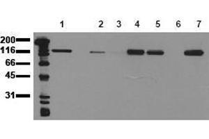 Western Blotting (WB) image for anti-Cadherin 1, Type 1, E-Cadherin (Epithelial) (CDH1) antibody (ABIN126734) (E-cadherin Antikörper)