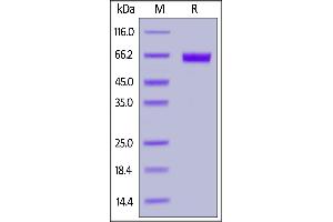 Human TROP-2, Fc Tag on  under reducing (R) condition. (TACSTD2 Protein (AA 27-274) (Fc Tag))