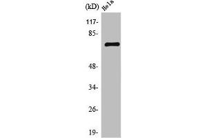 Western Blotting (WB) image for anti-BRF1, RNA polymerase III transcription initiation factor subunit (BRF1) (Internal Region) antibody (ABIN7188268)