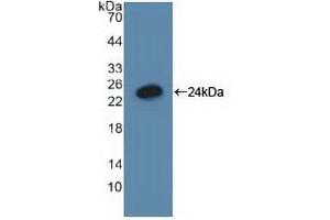 Detection of Recombinant GADD45a, Human using Polyclonal Antibody to Growth Arrest And DNA Damage Inducible Protein Alpha (GADD45a)