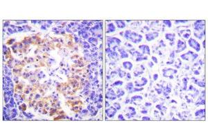 Immunohistochemistry analysis of paraffin-embedded human pancreas tissue, using Collagen Type III antibody.