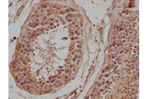 IHC image of ABIN7139940 diluted at 1:500 and staining in paraffin-embedded human testis tissue performed on a Leica BondTM system.