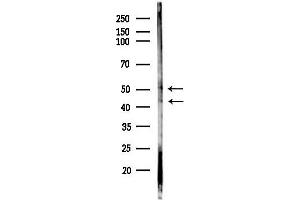 Western blot analysis of lysates from Raji cells(heat-shock,45 min treatment), using Phospho-CCR5 (Ser349) Antibody at 1/1000 dilution.
