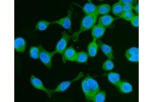 IF analysis of Drebrin/DBN1 using anti-Drebrin/DBN1 antibody (ABIN7602638).