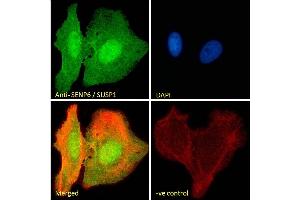 (ABIN334488) Immunofluorescence analysis of paraformaldehyde fixed U2OS cells, permeabilized with 0. (SENP6 Antikörper  (Internal Region))