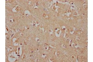 IHC image of nphHU diluted at 1:100 and staining in paraffin-embedded human brain tissue performed on a Leica BondTM system. (MAP3K7 Antikörper  (AA 179-194))