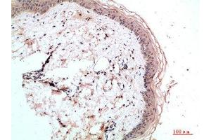 Immunohistochemical analysis of paraffin-embedded human-skin, antibody was diluted at 1:200 (RCC1 Antikörper  (AA 301-350))