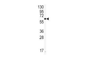Western blot analysis of anti-CYP2J2 Antibody (Center)  in CEM cell line lysates (35 μg/lane). (CYP2J2 Antikörper  (AA 156-183))