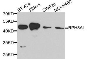 Western blot analysis of extract of various cells, using RPH3AL antibody. (RPH3AL Antikörper)