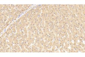Detection of THRb in Human Liver Tissue using Polyclonal Antibody to Thyroid Hormone Receptor Beta (THRb) (THRB Antikörper  (AA 239-457))