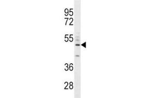 CD14 antibody western blot analysis in A549 lysate. (CD14 Antikörper  (AA 292-322))