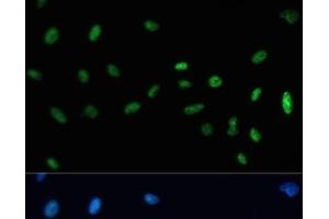 Immunofluorescence analysis of U-2 OS cells using SAFB Polyclonal Antibody at dilution of 1:100. (SAFB Antikörper)