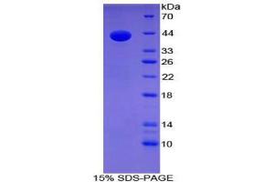 SDS-PAGE (SDS) image for Gastrin (GAST) (AA 1-101) protein (His tag,GST tag) (ABIN2122893) (Gastrin Protein (GAST) (AA 1-101) (His tag,GST tag))