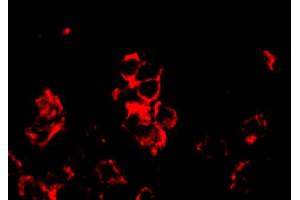 Frozen human synovial tissue section was stained with Mouse Anti-Human CD8-BIOT, IL-17F and their receptors in synovium of rheumatoid arthritis, psoriatic arthritis and osteoarthritis: possible explanation for nonresponse to anti-IL-17 therapy? (CD8 Antikörper  (Biotin))