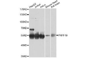 Western blot analysis of extracts of various cell lines, using PRPF19 antibody (ABIN6293423) at 1:1000 dilution. (PRP19 Antikörper)