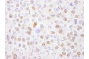 Immunohistochemistry (IHC) image for anti-Myocyte Enhancer Factor 2A (MEF2A) (AA 175-225) antibody (ABIN7454560) (MEF2A Antikörper  (AA 175-225))