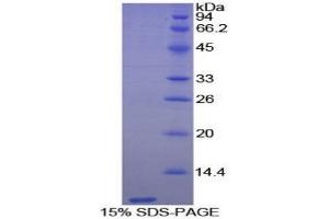 SDS-PAGE (SDS) image for Trefoil Factor 3 (Intestinal) (TFF3) (AA 24-80) protein (His tag) (ABIN1099550) (TFF3 Protein (AA 24-80) (His tag))