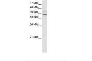 Image no. 1 for anti-Transmembrane Protein 175 (TMEM175) (AA 34-83) antibody (ABIN202675) (TMEM175 Antikörper  (AA 34-83))
