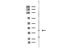 anti-PIN2/TERF1 Interacting, Telomerase Inhibitor 1 (PINX1) (Internal Region) antibody