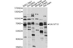 Western blot analysis of extracts of various cell lines, using GALNT10 antibody (ABIN6293992) at 1:1000 dilution. (GALNT10 Antikörper)